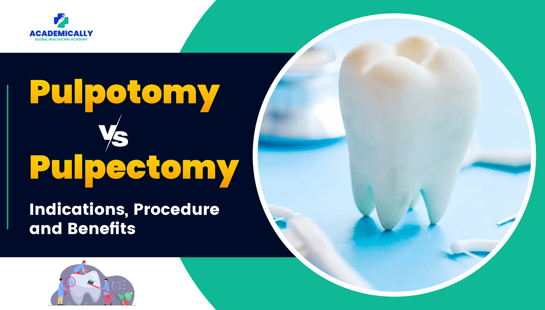 Pulpotomy vs Pulpectomy Indications, Procedure & Benefits | Academically