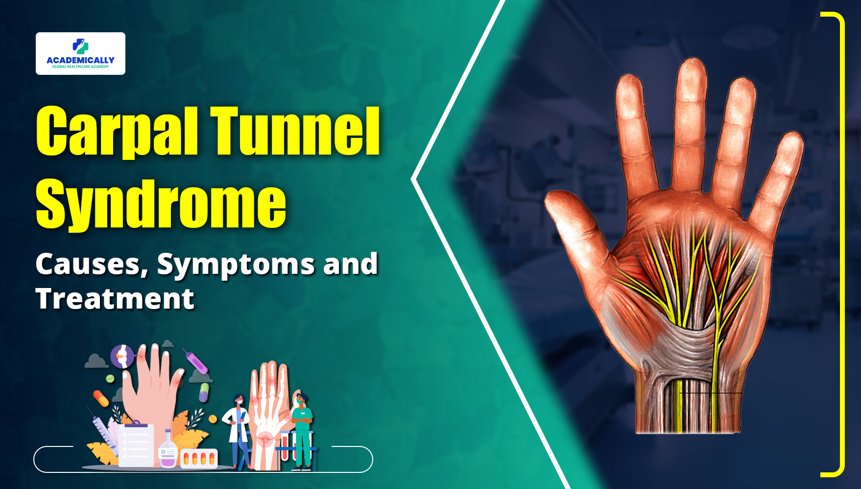 Carpal Tunnel Syndrome | Academically Global